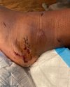 51789695-12387001-Megan_took_to_Instagram_with_a_photo_of_her_foot_injury_followin-a-19_169153...jpg